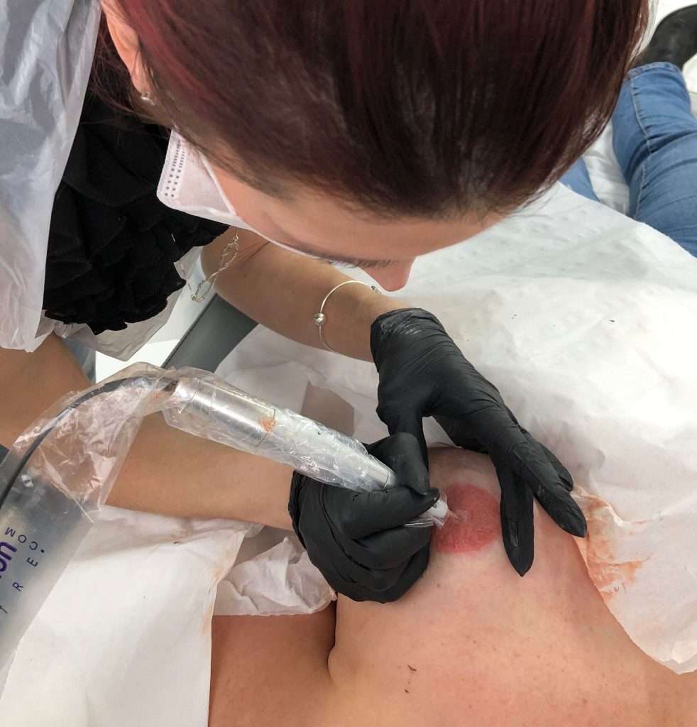 Emma performing areola tattooing on client